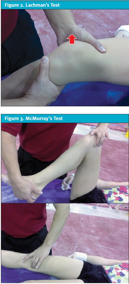 Figures 2 and 3 of evaluation of Knee Pain