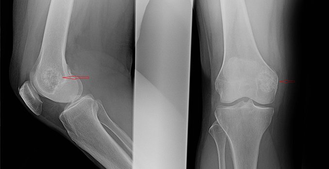 Incident finding on patients pathology x-ray