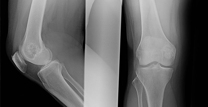 Incident finding on patients pathology x-ray