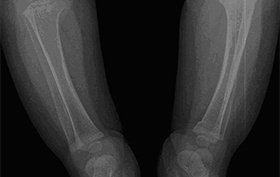 10-month old child with 3 day history of pain