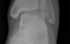 26-year-old male who twisted his ankle