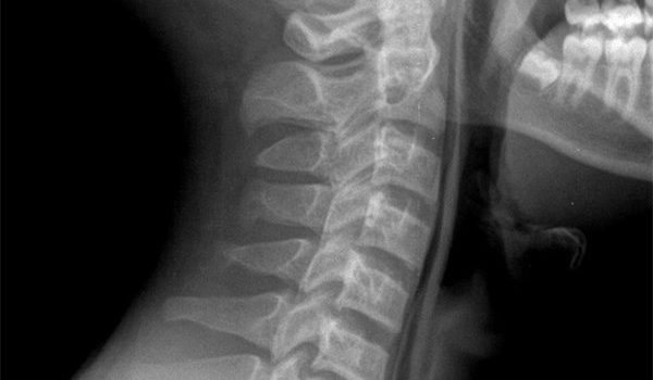 16-year-old male experiencing chest and throat pain
