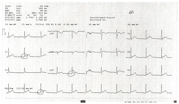 17-year-old male has persistent chest pain