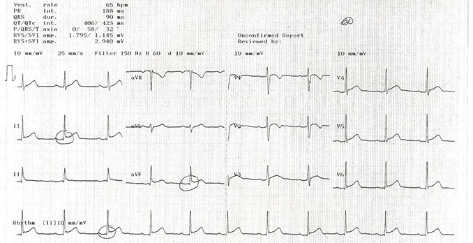 iucc123aThumb