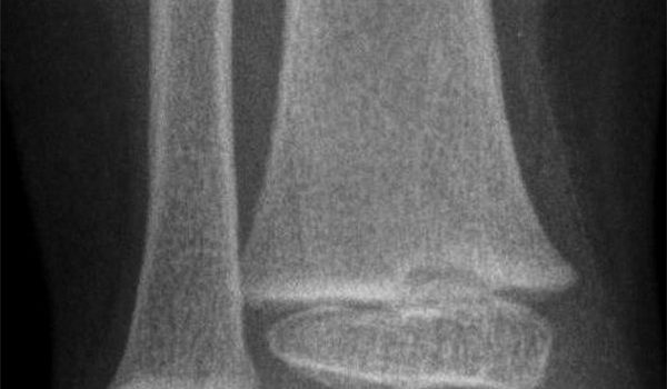3-year-old boy suffering a blow to his leg
