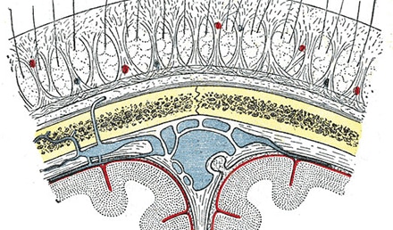 Dissecting Cellulitis of the Scalp