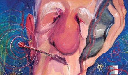 An Old Condition Presents New Challenges: A Case Report of Acute Rheumatic Fever
