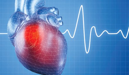 Acute MI After a Normal Stress Test