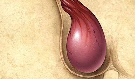 Assessment and Management of Scrotal Disorders