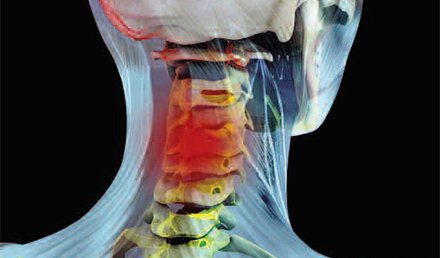 Evaluation and Management of Neck Pain in Urgent Care