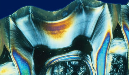 Management of Acute Orofacial Pain Syndromes