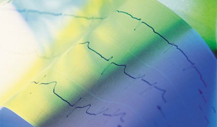 Chest Pain, Bradycardia, and ECG Changes in Acute Cholecystitis