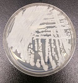 Clinicians Take Note: CDC Warns of Deadly Drug-Resistant Candida auris in the U.S.