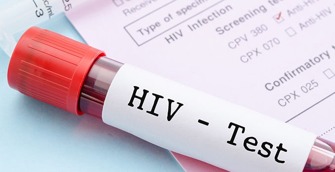 Original Research: HIV Screening in the Urgent Care Setting