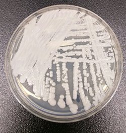 Update: U.S. Candida auris Cases Have More Than Doubled