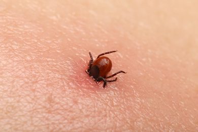 Get Ready for an Uptick in Tick-Related Visits