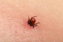 Point-of-Care Lyme Test Could Reduce Referrals Out of Urgent Care