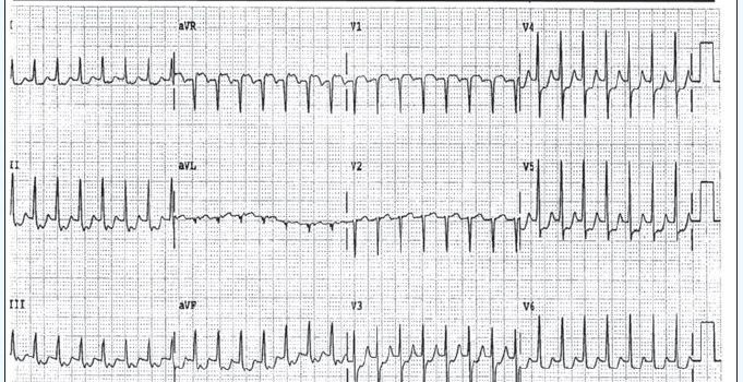 Clinical Challenge 2: October 2017