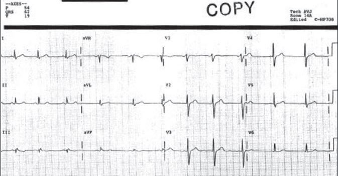 A 26-Year-Old Man with Palpitations