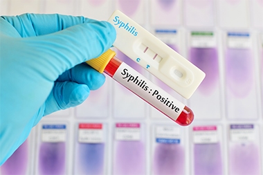 Syphilis in the Urgent Care Center