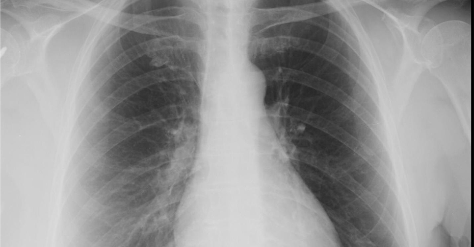 A 63 Year Old Woman With A 4 Day History Of Coughing Page 2 Of 2