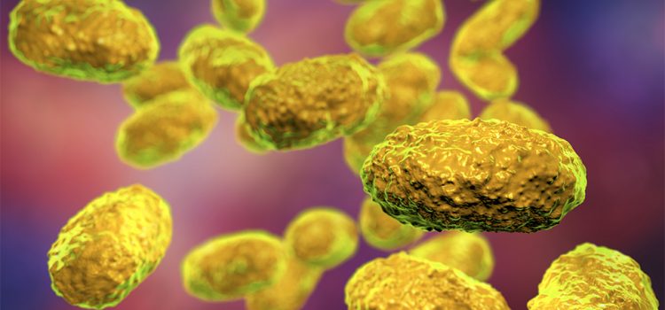Suspected Pertussis in Infants and Adolescents—What to do? Suspected Pertussis in Infants and Adolescents—What to do?