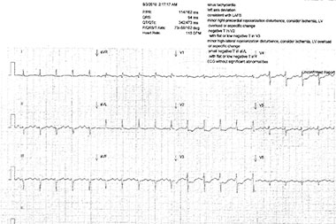 A 55-Year-Old Man with a 2-Day History of Respiratory Symptoms, Palpitations, and Dizziness