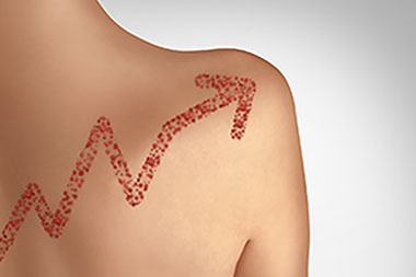Urgent Care Can Help Curb the Measles Explosion by Educating Patients and Parents