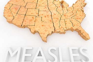Warn Patients: Before Going on Vacation, Know the Measles Situation Where You’re Heading