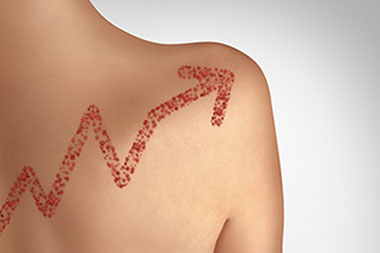 Measles Data Provide Ammunition for Immunization Discussions—Use It