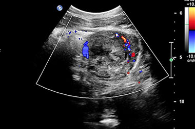 Free JUCM Webinars: Do Ultrasound (and All Imaging) the Right—and Profitable—Way