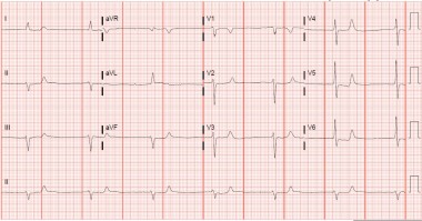 A 50-Year-Old Male with Several Chronic Conditions and Foot Pain at an Amputation Site