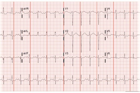 A 20-Year-Old Female with an Array of Gastro Symptoms