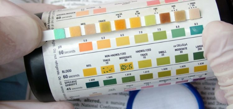 Urinalysis: A Simple Test with Complicated Interpretation