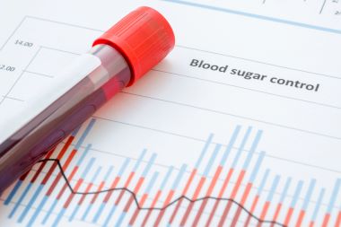 Here’s One More Dire Reason to Be Aware of Fasting Blood Glucose in COVID-19 Here’s One More Dire Reason to Be Aware of Fasting Blood Glucose in COVID-19