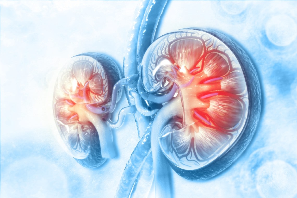 A POCUSBased Approach to Acute Renal Colic in the Urgent
