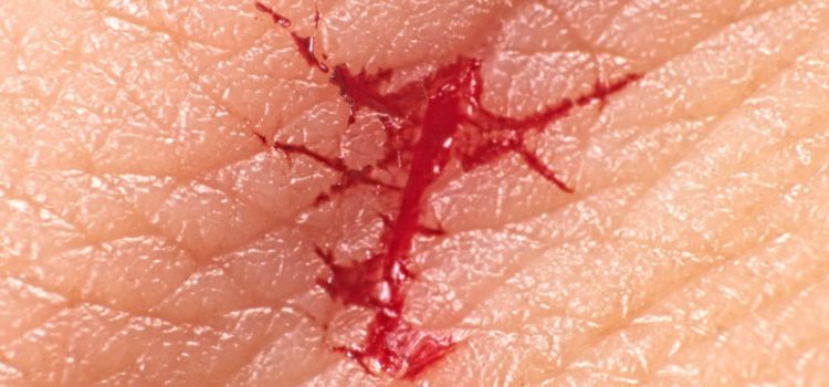 The Role of Aseptic Technique During Repair of Traumatic Lacerations in the Urgent Care Center