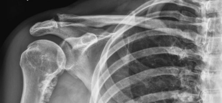 A 52-Year-Old Male with Upper Arm Pain and Swelling of No Known Origin A 52-Year-Old Male with Upper Arm Pain and Swelling of No Known Origin