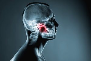 Odontogenic Infection, Man with x-ray of head and red area indicating issue in mouth