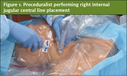 Proceduralist performing right internal jugular central line placement; Gender Bias