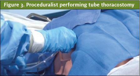 Proceduralist performing tube thoracostomy. Gender Bias