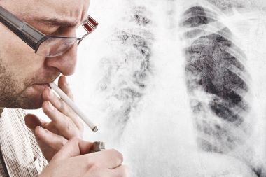 Advise Patients: A Worldwide Respiratory Pandemic is a Bad Time to Start Smoking Again