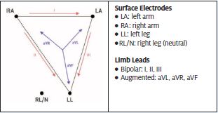relationship between limb leads and surface electrodes are defined by Einthoven’s triangle 