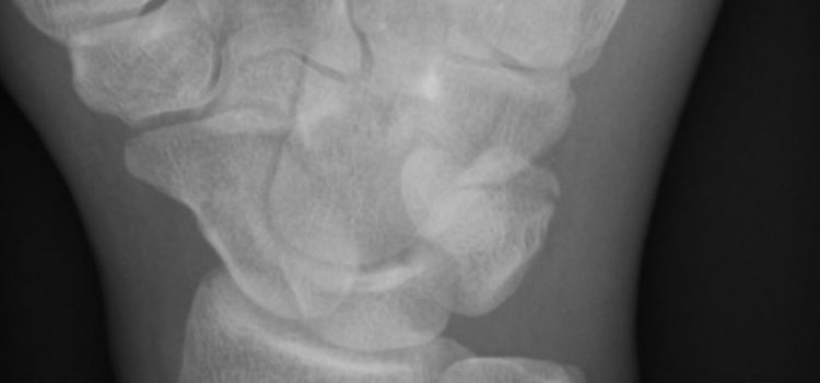 A 28-Year-Old Boxer with Wrist Pain After a Bout