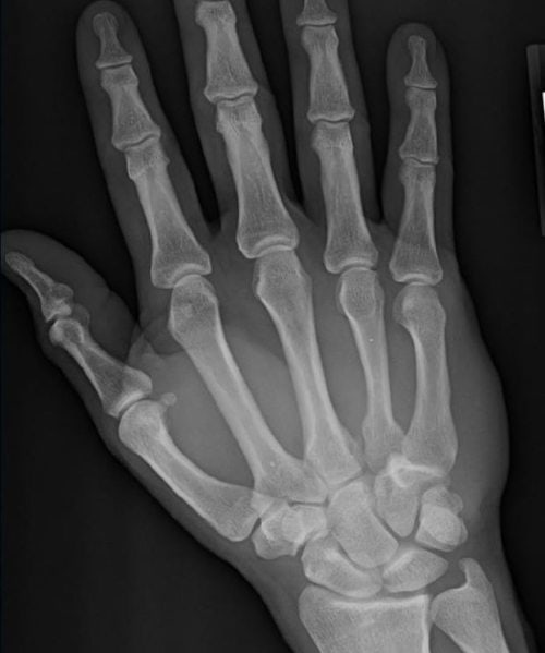 36-year-old man with wrist pain after a traumatic impact