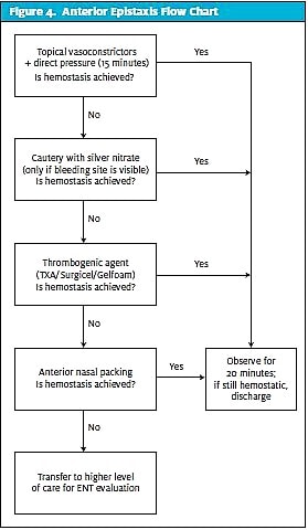 Anterior Epistaxis Flow Chart