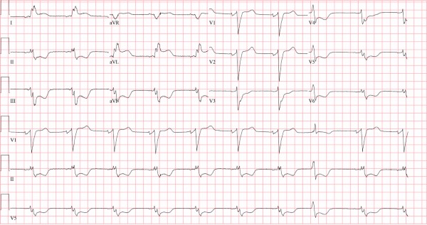 Figure 1 of ECG Image