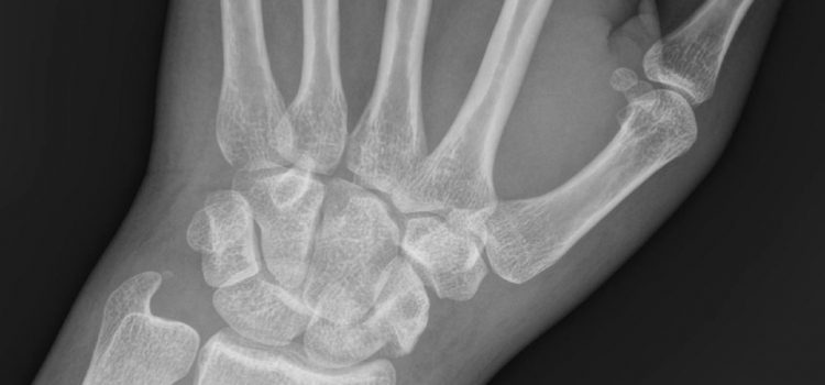 A 23-Year-Old with Wrist Pain After a Mountain Bike Mishap