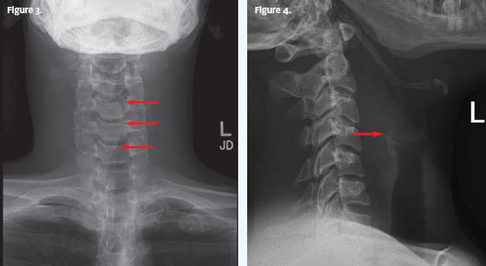 02.22 JUCM Clinical Challenges Figure 3 & 4