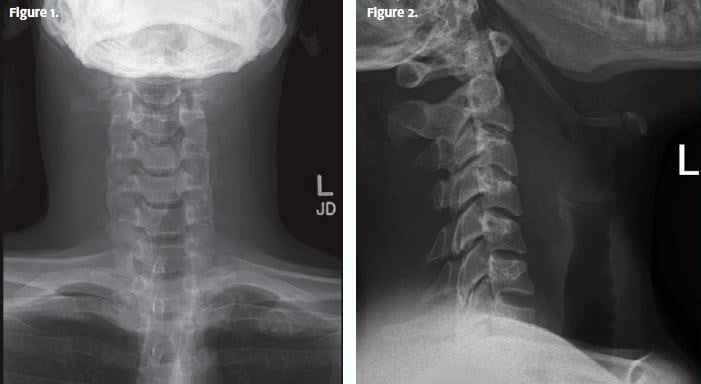 02.22 JUCM X-Ray Clinical Challenges Figures 1 & 2